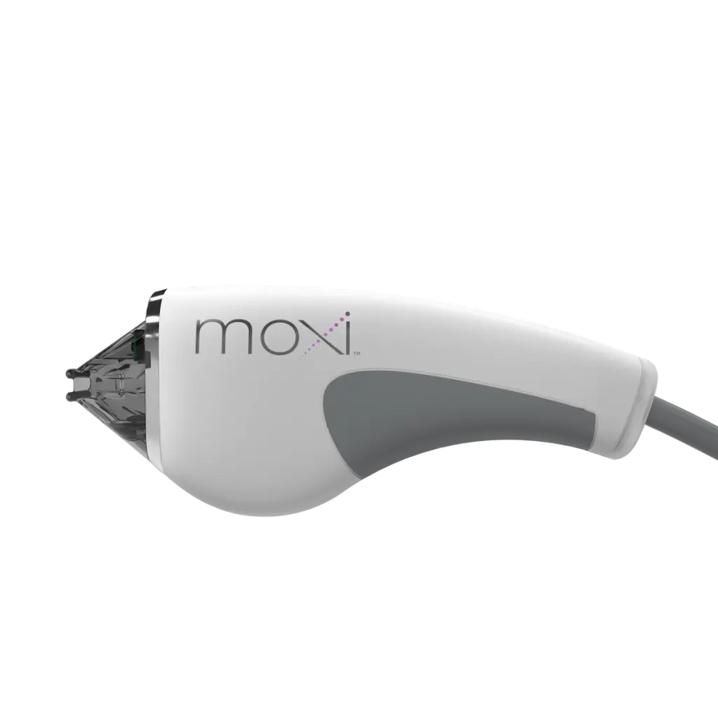 Moxi laser treatment at Dermatology Laser Center & Medispa, Owings Mills, MD