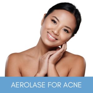 Woman smiling with clear skin after aerolase for acne treatment.