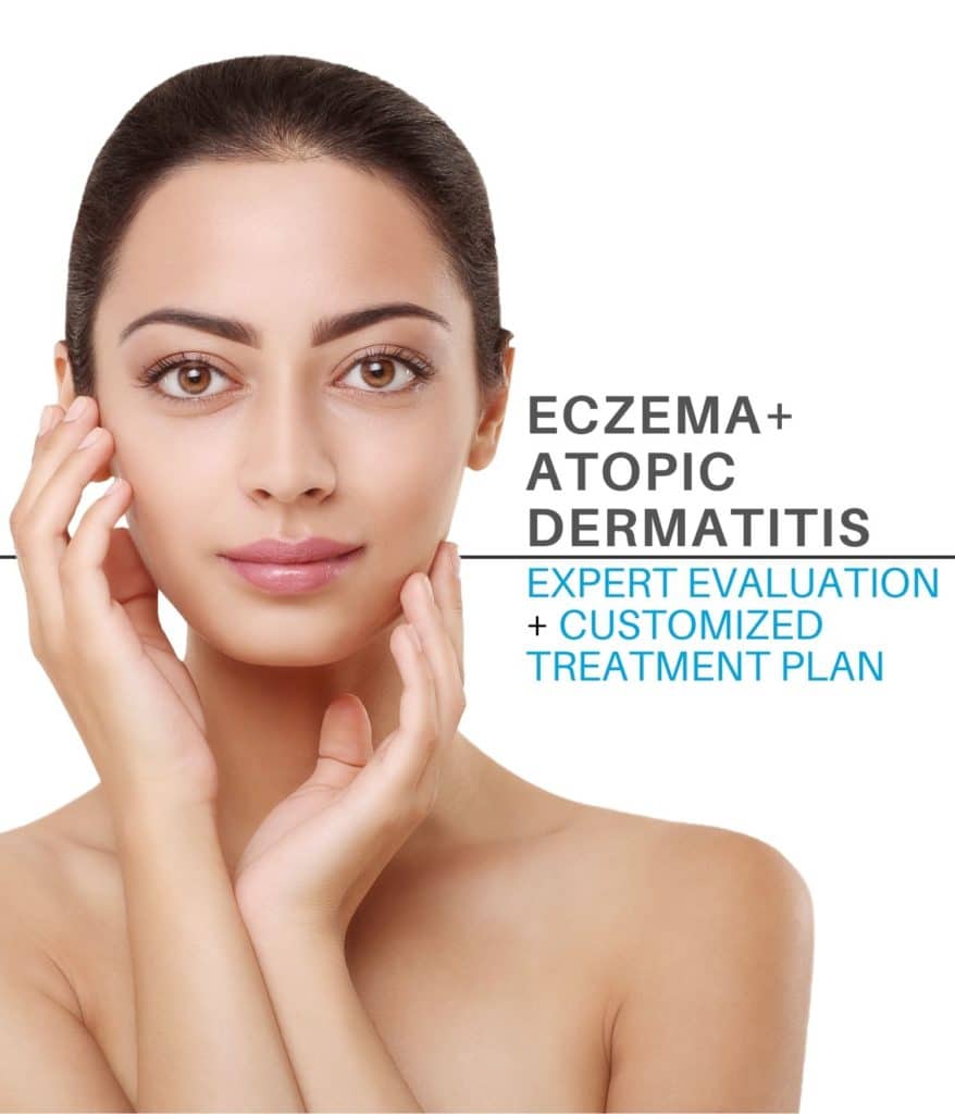 Eczema And Atopic Dermatitis Treatment In Baltimore Md