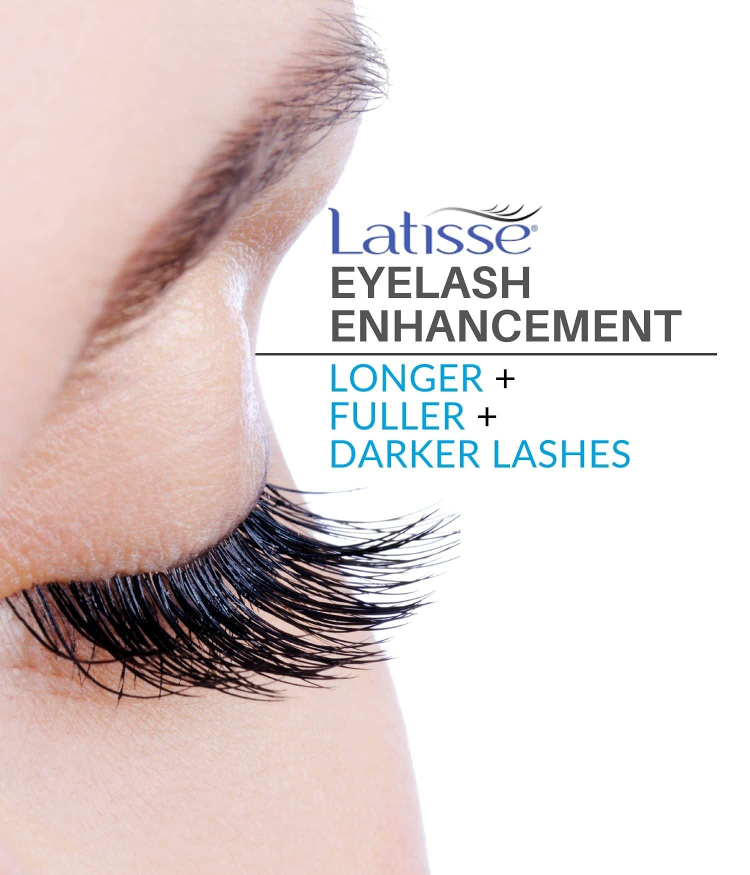 Woman's eyelash with Latisse eyelash enhancement.
