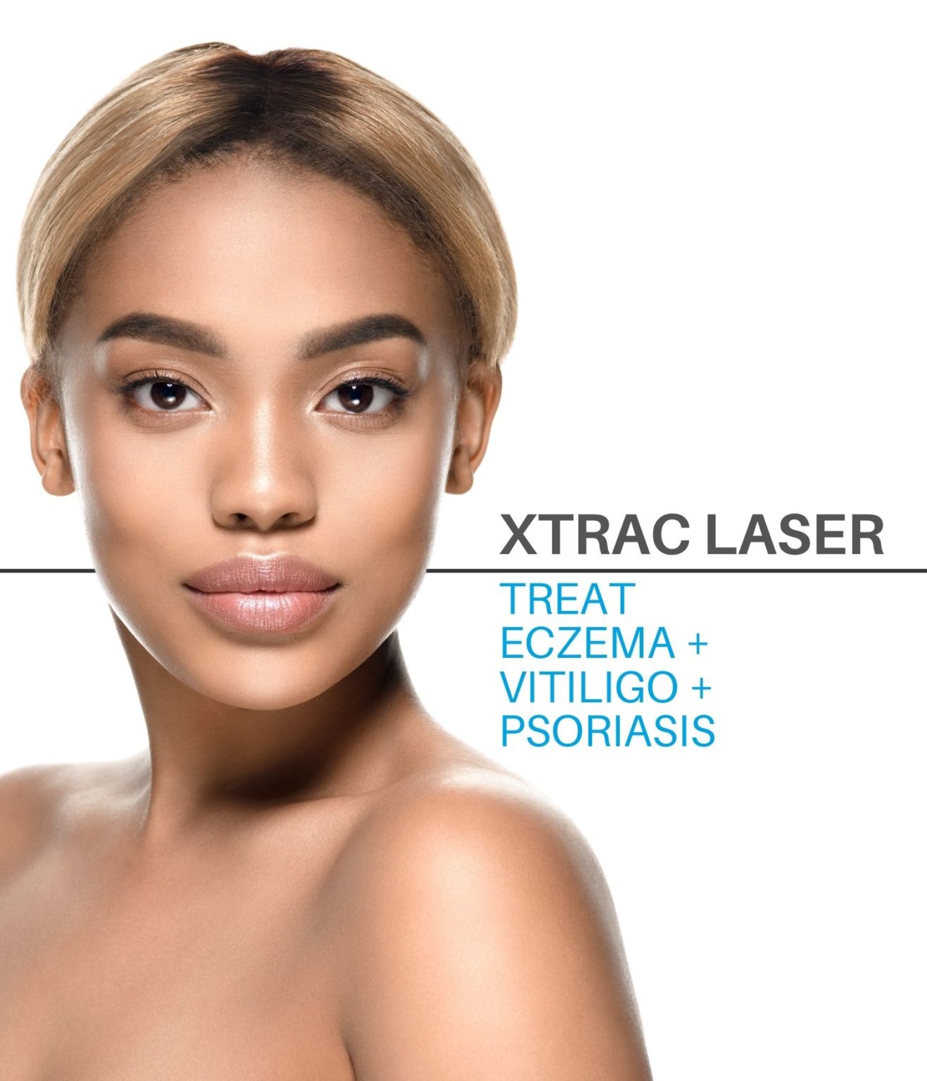 Xtrac Laser Therapy | UV Light Treats Vitiligo, Psoriasis & Eczema