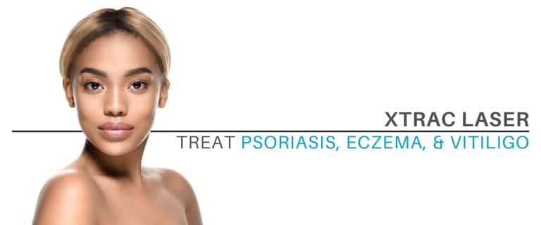 xtrac-laser-ultraviolet-light-treats-vitiligo-psoriasis-eczema