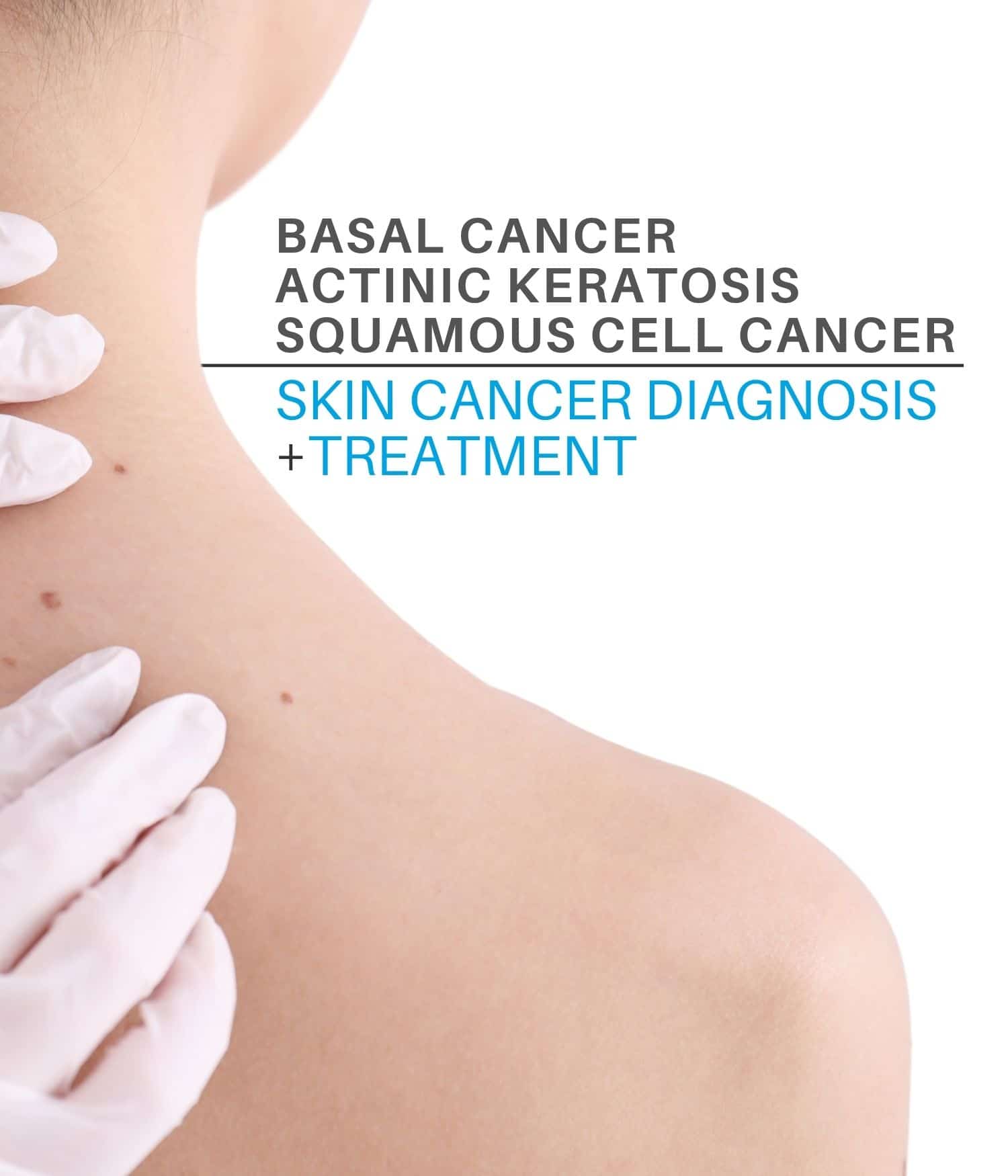 Basal Cell Cancer, Squamous Cell Cancer, Actinic Keratosis.