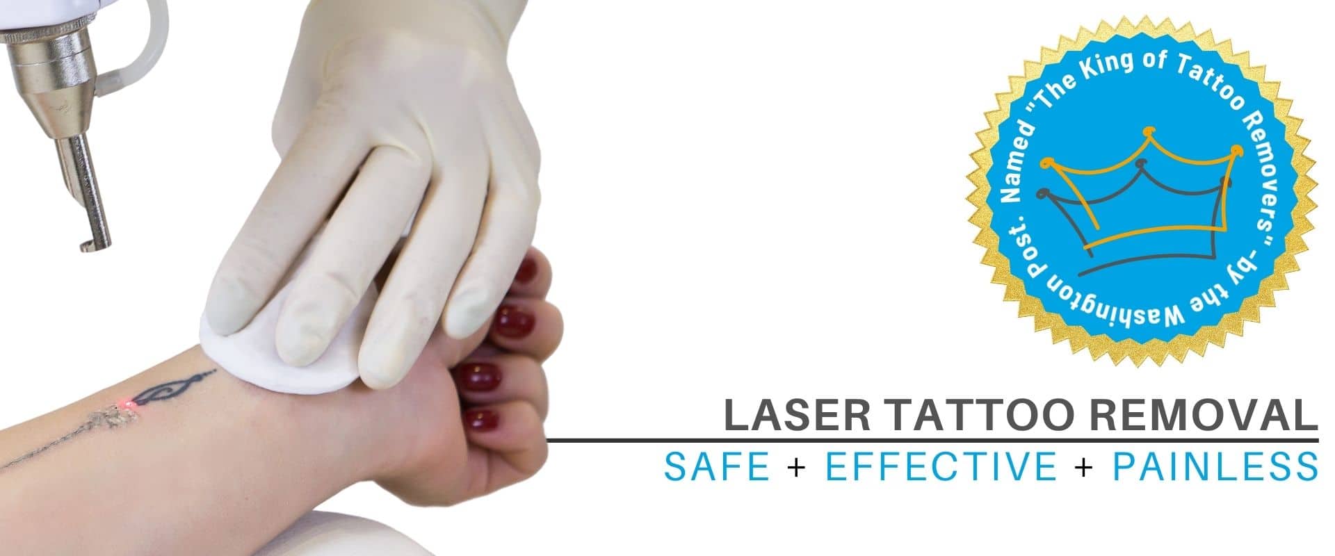 Person getting laser tattoo removal on their wrist at Laser Doc MD.