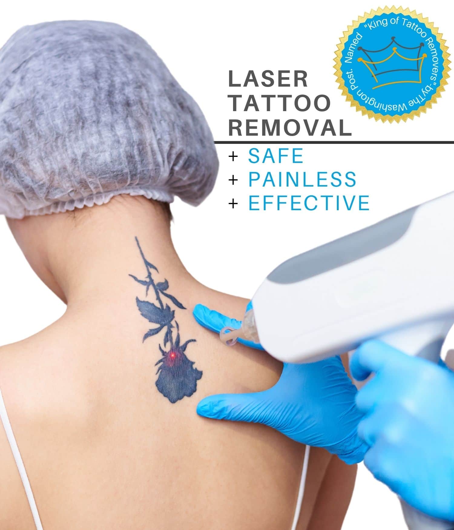 Woman getting laser tattoo removal on her back at Laser Doc MD.